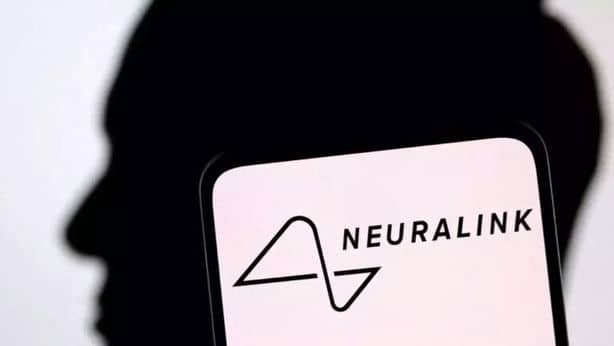 Первый пациент Neuralink смог управлять мышью силой мысли
